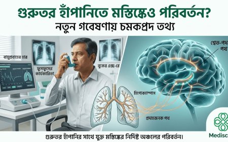 গুরুতর হাঁপানিতে মস্তিষ্কেও পরিবর্তন? নতুন গবেষণায় চমকপ্রদ তথ্য